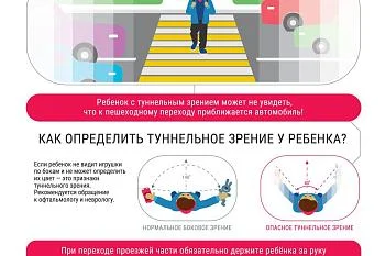 Туннельное зрение